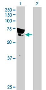 CAMKK1 Polyclonal Antibody, MaxPab™