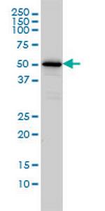 CAMKK1 Monoclonal Antibody (1F6)