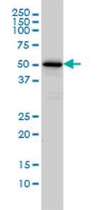 CAMKK1 Antibody in Western Blot (WB)