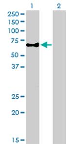 CAMKK1 Antibody in Western Blot (WB)