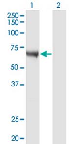 CAMKK1 Monoclonal Antibody (4B4)