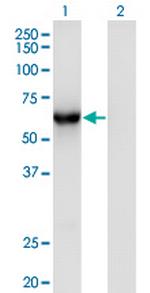 CAMKK1 Monoclonal Antibody (3B4)
