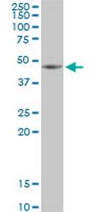 HSDL2 Polyclonal Antibody, MaxPab™