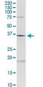 HAGHL Monoclonal Antibody (5B12)