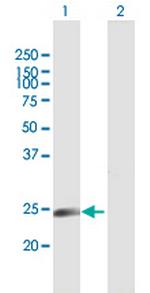 NICN1 Antibody in Western Blot (WB)