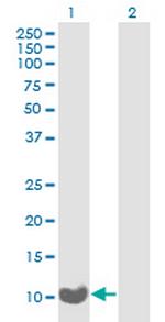 C17orf37 Antibody in Western Blot (WB)