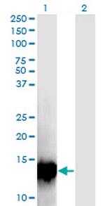 C17orf37 Monoclonal Antibody (4D4)
