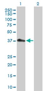 PDCD2L Antibody in Western Blot (WB)