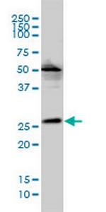 MGC10540 Monoclonal Antibody (2E5-2B9)