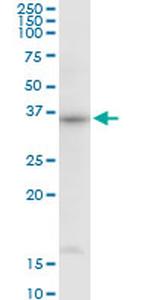 THOC3 Antibody in Western Blot (WB)