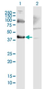 THOC3 Antibody in Western Blot (WB)