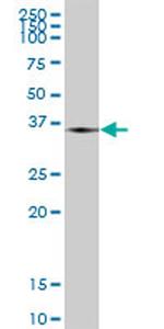 THOC3 Antibody in Western Blot (WB)