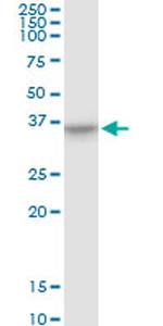THOC3 Antibody in Western Blot (WB)