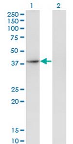 THOC3 Monoclonal Antibody (3D4)