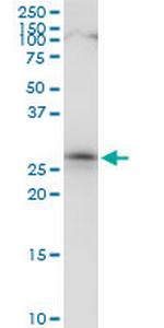 CIP29 Polyclonal Antibody, MaxPab™