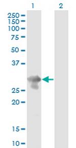 PCGF5 Monoclonal Antibody (3C10)