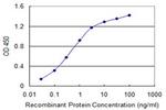 MCM8 Monoclonal Antibody (1F9)