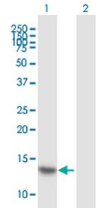 HOP Polyclonal Antibody, MaxPab™