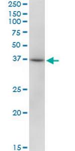 RHOXF2 Polyclonal Antibody, MaxPab™