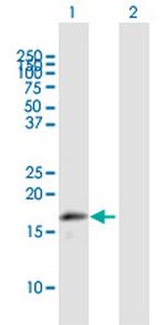 MRPL43 Antibody in Western Blot (WB)