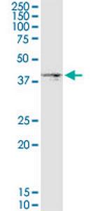 DGAT2 Monoclonal Antibody (4C1)