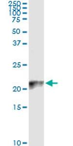 COX4I2 Antibody in Immunoprecipitation (IP)