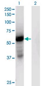 GPT2 Monoclonal Antibody (7A11)