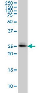 GRCC9 Monoclonal Antibody (1E6)