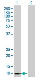 FUT10 Antibody in Western Blot (WB)