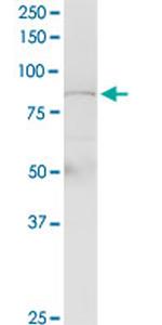 PLCD4 Antibody in Western Blot (WB)