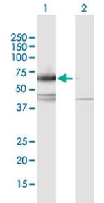 IL17RC Antibody in Western Blot (WB)