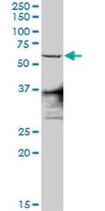 ZNF496 Antibody in Western Blot (WB)