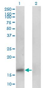 PHF5A Antibody in Western Blot (WB)