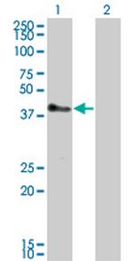 TRIM52 Monoclonal Antibody (6D5)