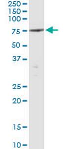 PTPN5 Monoclonal Antibody (2H5)