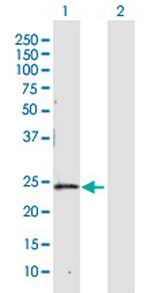 CBR4 Polyclonal Antibody, MaxPab™