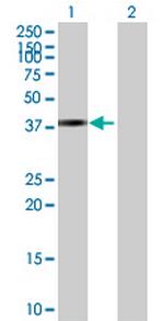 ZNF514 Antibody in Western Blot (WB)