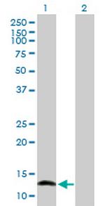 NFATC2IP Polyclonal Antibody, MaxPab™