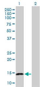 NFATC2IP Antibody in Western Blot (WB)