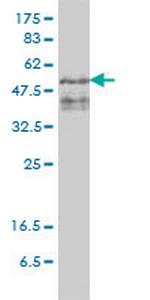 ZFYVE19 Monoclonal Antibody (4D5-2D11)
