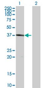 HSH2D Polyclonal Antibody, MaxPab™