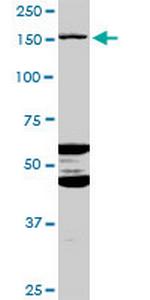 ABCC11 Polyclonal Antibody, MaxPab™