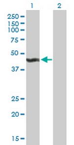 ALG2 Polyclonal Antibody, MaxPab™