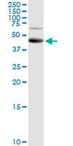 ALG2 Polyclonal Antibody, MaxPab™