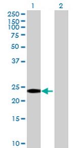 RGS8 Polyclonal Antibody, MaxPab™