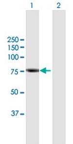 RHPN2 Antibody in Western Blot (WB)