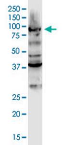 DCLK3 Monoclonal Antibody (2B1)