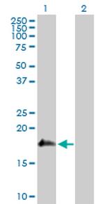 SSH2 Polyclonal Antibody, MaxPab™