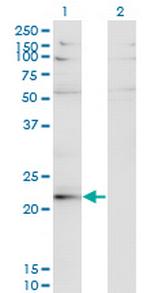 LBX2 Monoclonal Antibody (3A5)