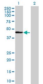 HSFY1 Polyclonal Antibody, MaxPab™